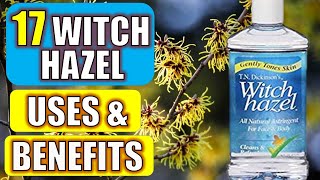 17 Surprising Witch Hazel Benefits & Uses (HEALTH | BEAUTY | CLEANING)