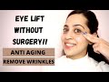 How to get an eye lift | remove  wrinkles FAST| Anti aging|Sonali Beauty
