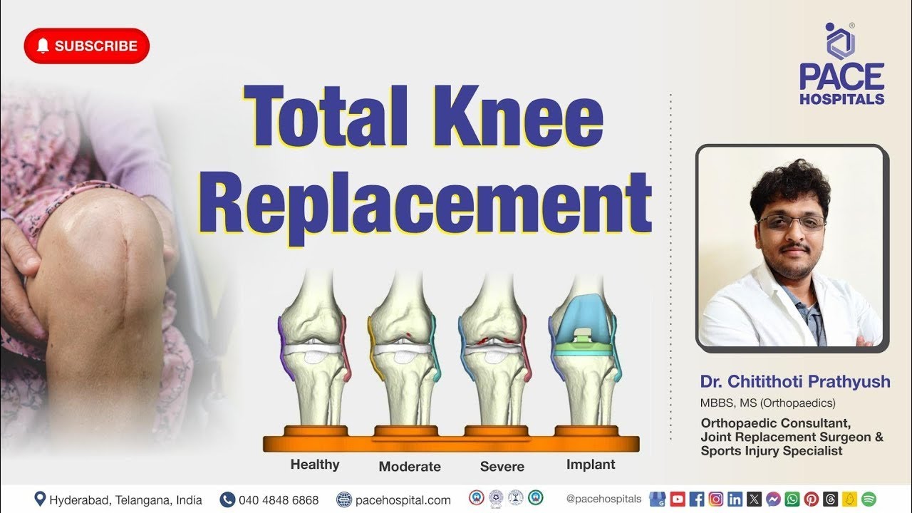 Know About Total Knee Replacement | | Dr Prathyush || Orthopedic ...