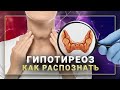 Гипотиреоз симптомы. Как распознать по анализам проблемы со щитовидкой.