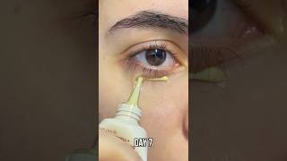 😱😳 КАК ИЗБАВИТЬСЯ ОТ СИНЯКОВ ПОД ГЛАЗАМИ? Seoul 1988 Eye cream #кремдляглаз #ksecret #seoul1988
