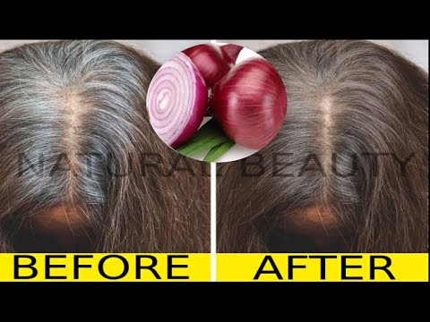 How to treat gray hair with onions in just 5 minutes tested before and after