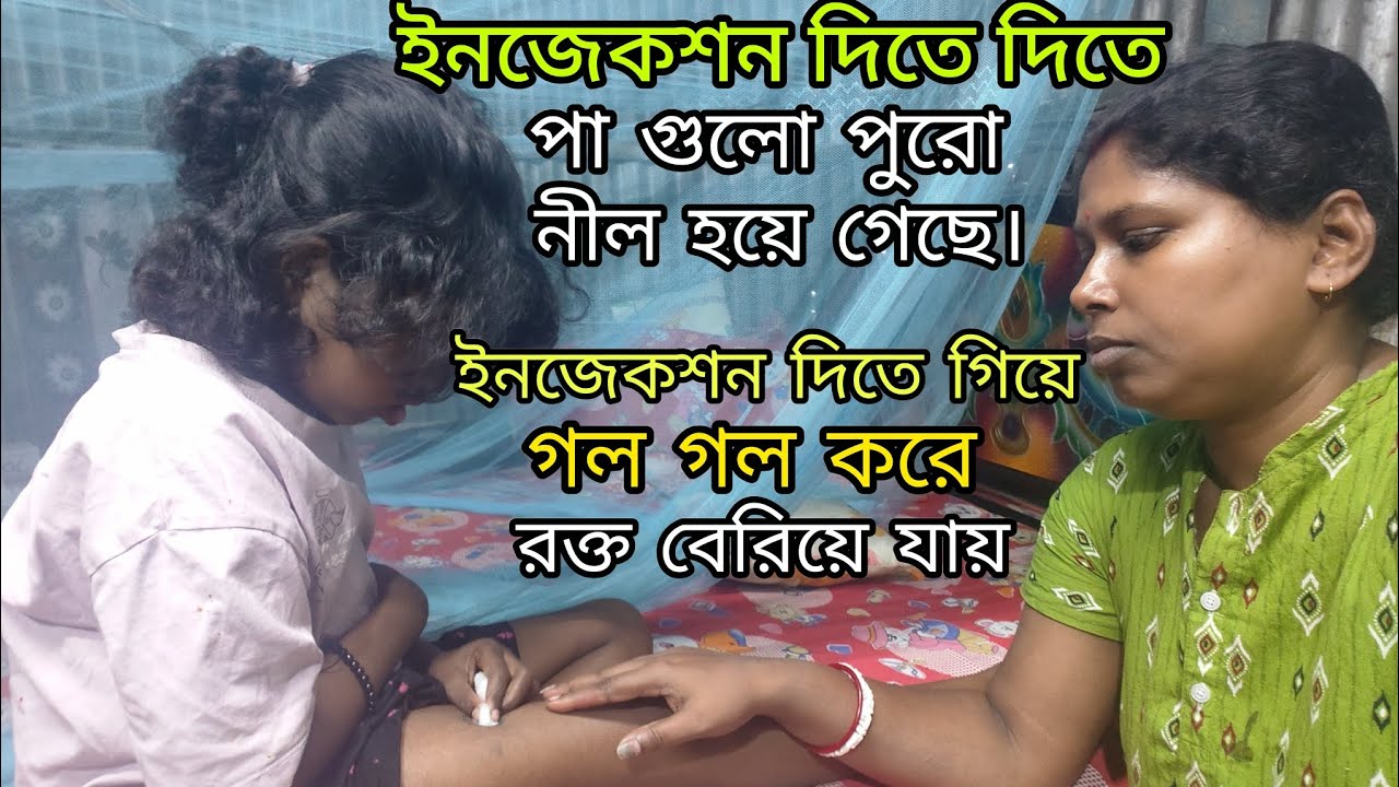 ননদ বৌদি মিলে সকালবেলায় কাজে লেগে পড়লাম,  বলে বোঝাতে পারবো না মেয়েটার পা গুলো পুরো নীল হয়ে গেছে?