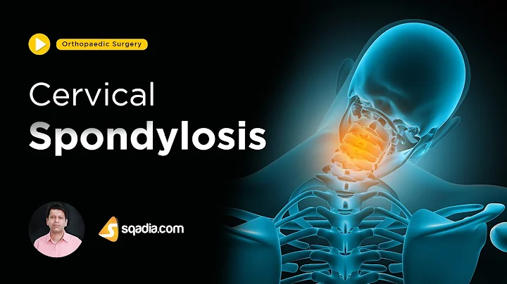 Cervical Spondylosis | Orthopedic Surgery Video | Medical Online Education | V-Learning