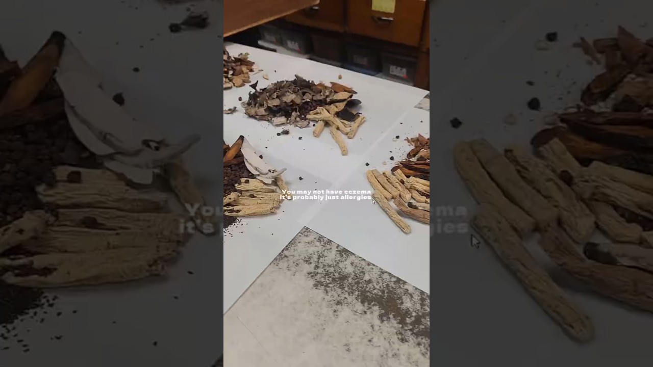 It’s not eczema it’s allergies 