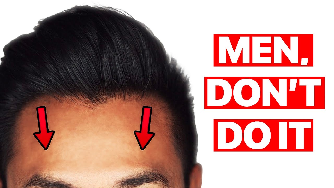 Why Hairline Lowering is NOT for Men!