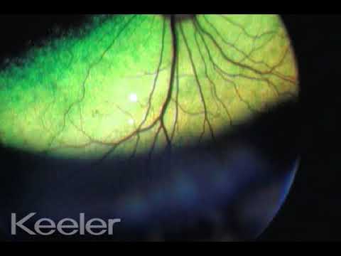 detached retina dog detached retina dog