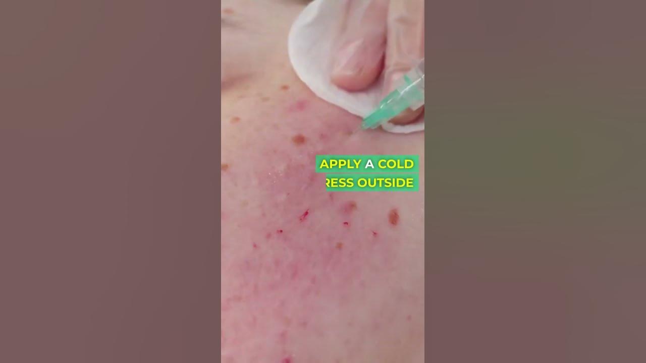 home-remedies-to-relieve-gas-pain-fast-youtube