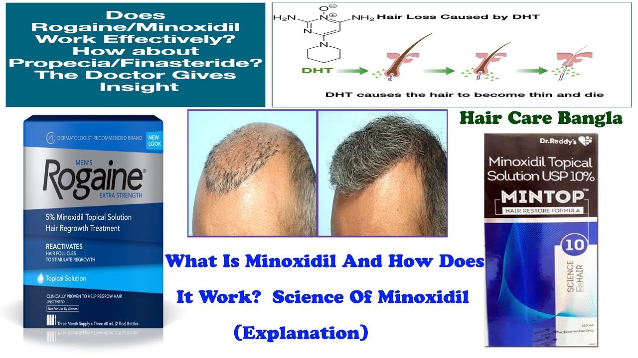 how long does minoxidil work