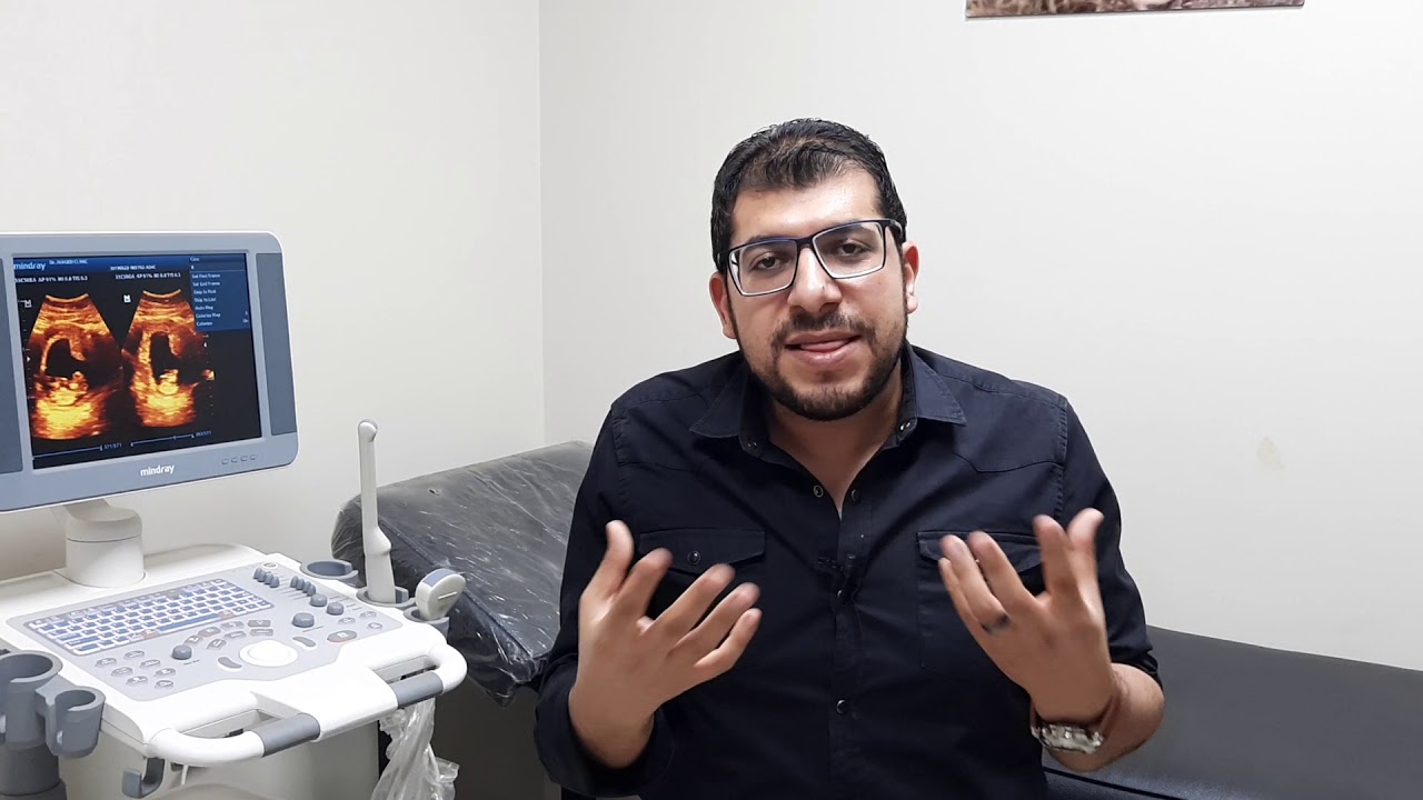 اختزال الاجنة