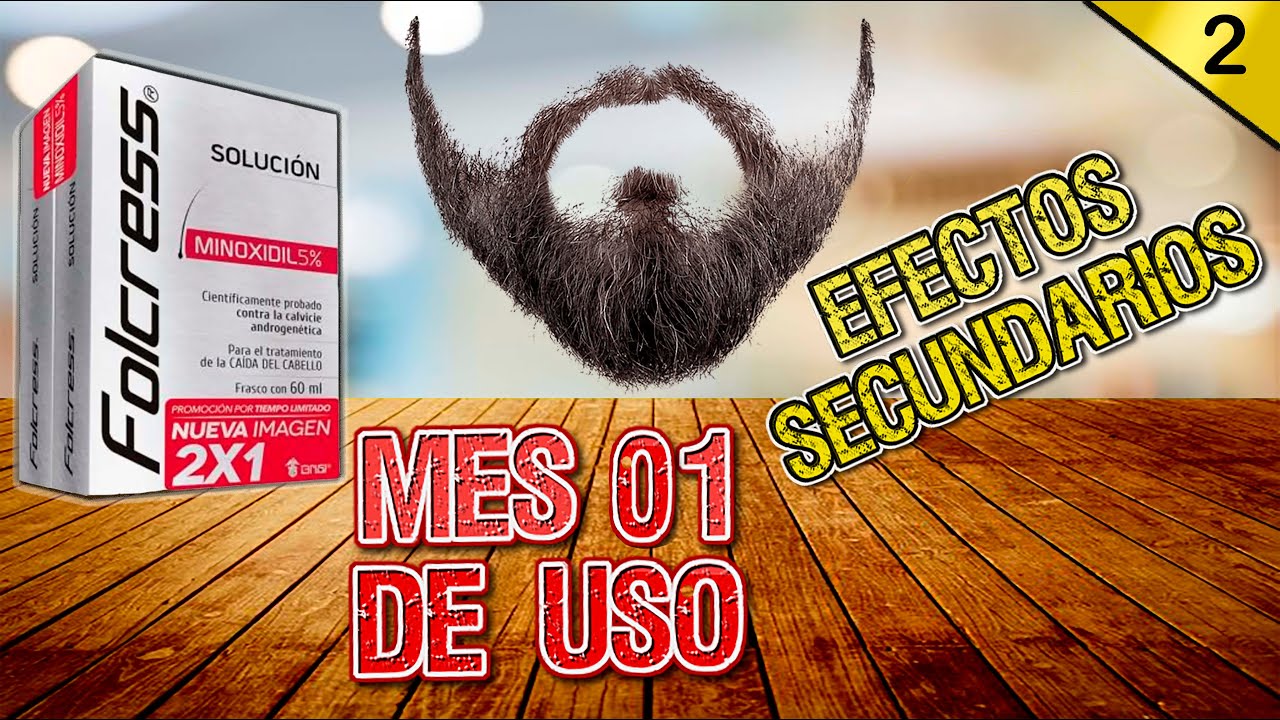 Tratamiento de Minoxidil para la Barba Mes 01 (Efectos Secundarios) YouTube
