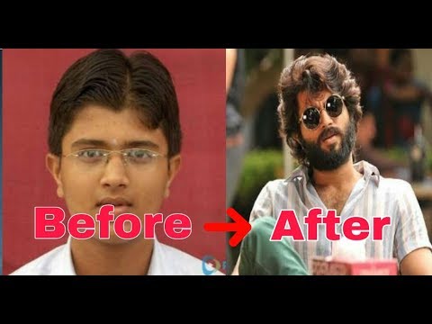 Celebrities BEFORE and AFTER Plastic Surgery | Ram Charan | Anushka