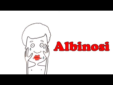 Wideo: Belchata - Albinosi Są Objęci Opieką - Alternatywny Widok