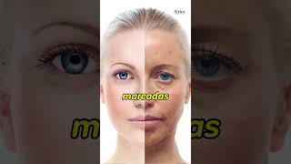 What is the best treatment for sagging skin and aging?