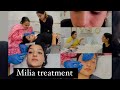 How to remove milia permanent on your face gurbilling skin care mohali best skincare support