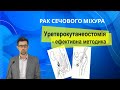 Рак сечового міхура: уретерокутанеостомія  - Bladder cancer: unilateral ureterocutaneostomy