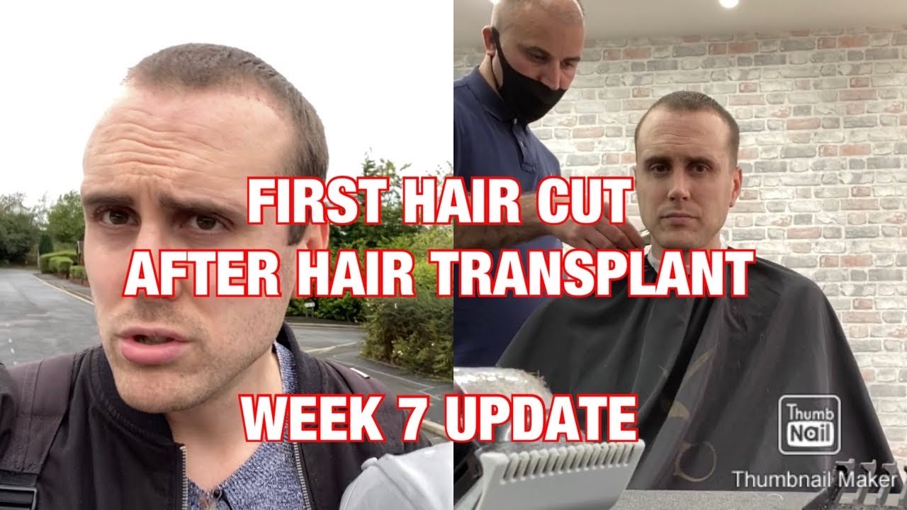 ПЕРВАЯ СТРИЖКА после пересадки волос в Стамбуле, Турция 🇹🇷 — Обзор 7-й недели (3500 графтов) 🇬🇧