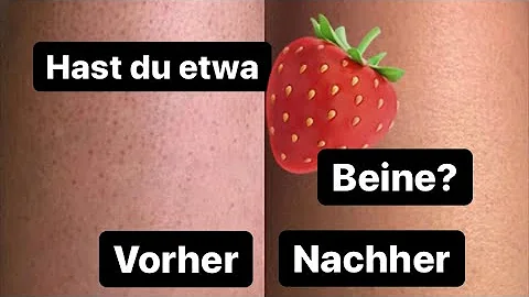 Wie bekommt man Erdbeerbeine?