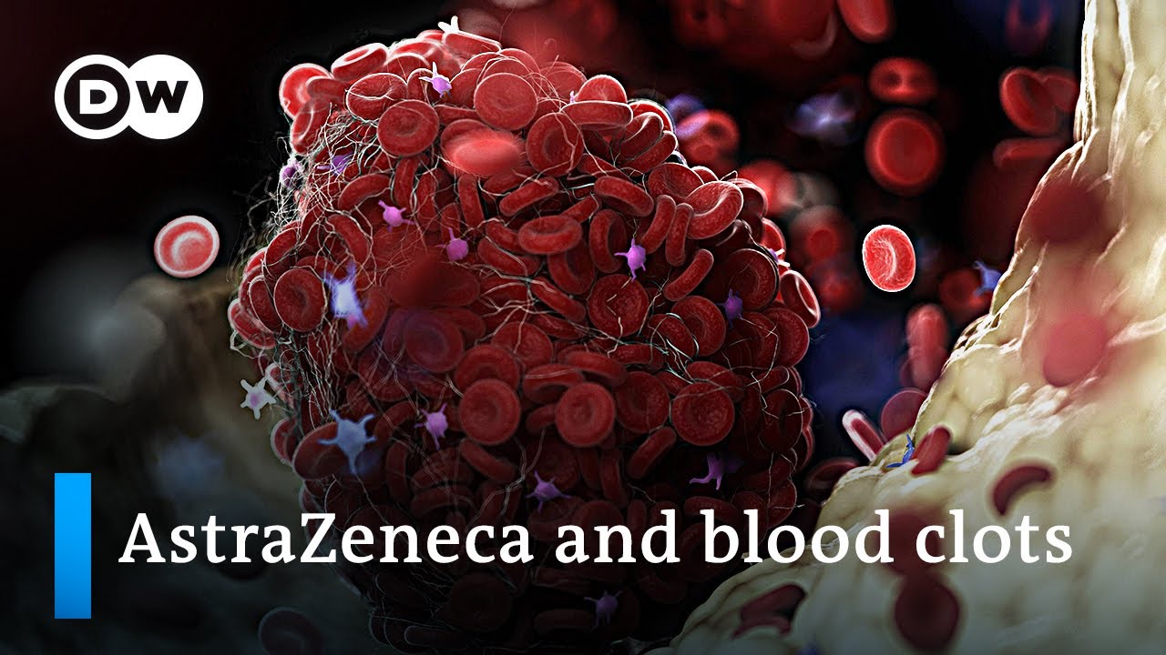 "Clear link between AstraZeneca and rare blood clots" DW News YouTube