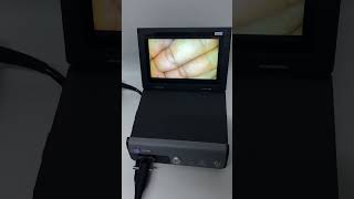 All-in-One Gastroscope Image Processor – Smarter Visualization for Medical Endoscopy!