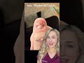 Doctor reacts: EXTREME nail injury