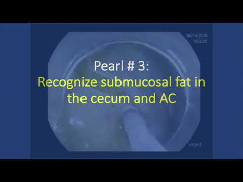 Video Endoscopy E Video Submission