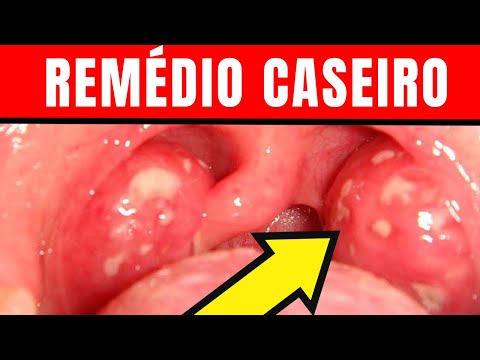 Remédio caseiro para