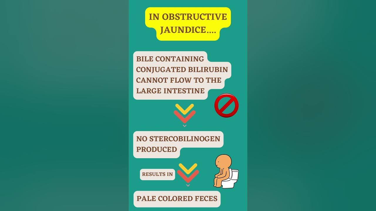WHY there is pale stools in OBSTRUCTIVE JAUNDICE? shorts YouTube