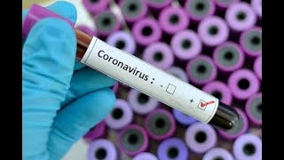 Qué es el Coronavirus? Contagio, Sus Síntomas y Tratamiento
