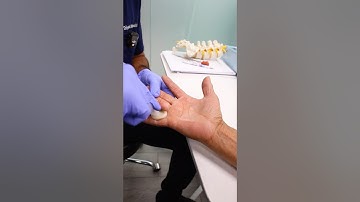 How to fix a trigger finger? #triggerfinger #painmanagement #painrelief