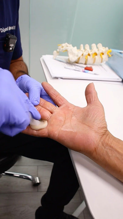 How to fix a trigger finger? #triggerfinger #painmanagement #painrelief
