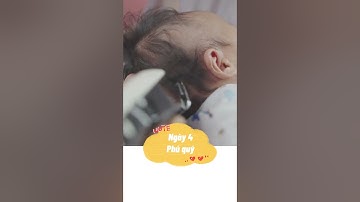 #shorts  Nên chọn ngày nào để cắt tóc máu cho con #tresosinh #chamsoctresosinh #trending #mebau