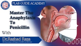 Anaphylaxis to Penicillin: SIMMAN Simulation | Step-by-Step Guide | PLAB GUIDE ACADEMY