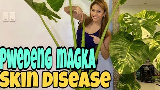 Gretchen Fullido - Pwedeng Magka Skin Disease