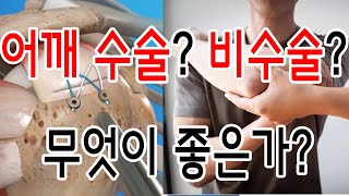 회전근개파열 수술이 좋은가? 비수술이 좋은가?