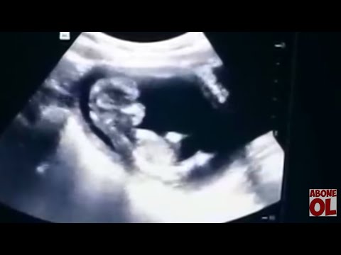 Video: 13 Haftalık Hamilelik: Duyular, Fetal Gelişim, Ultrason