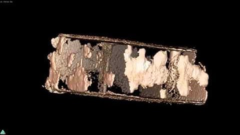 A Novel μCT Analysis Reveals Different Responses of Bioerosion and Secondary Accretion