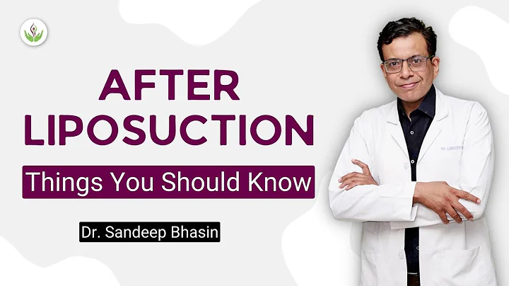 After Liposuction: Things You Should Know - Dr. Sa...