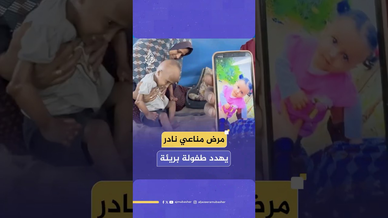 يفتك بجسدها الصغير يوما بعد يوم.. مرض مناعي نادر يهدد حياة الطفلة حلا الهنادي في قطاع غزة