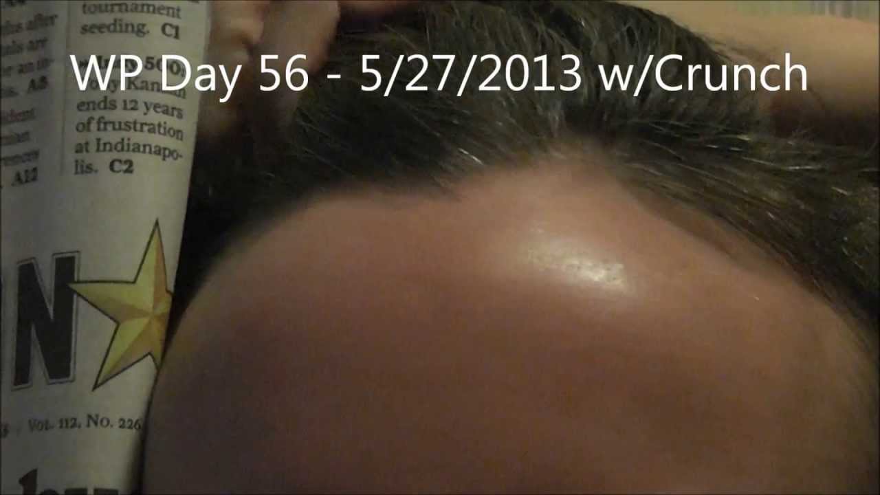 Anti Aging Before and After