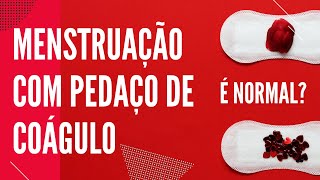 Menstruação com coágulos na endometriose - BedMed