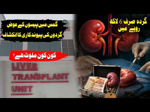 GIMS Scandal Kidney for Rs 600,000? Who’s Behind the GIMS Hospital Scandal?