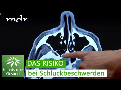 Video: Schluckbeschwerden erkennen – wikiHow