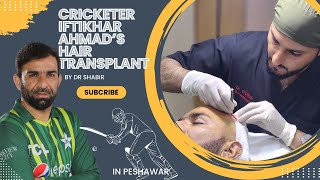Cricketer IFTIKHAR ahmad at Dr shabir's clinic for hair transplant  | Dr. Shabir Clinic