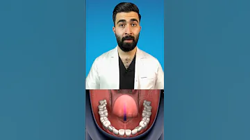 بلع اللسان 