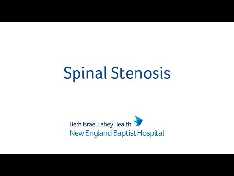 Low Back Pain Part 8: Spinal Stenosis. 