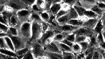 T cell transmigration through endothelial monolayer