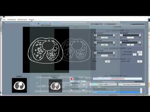 Digital image processing using matlab projects