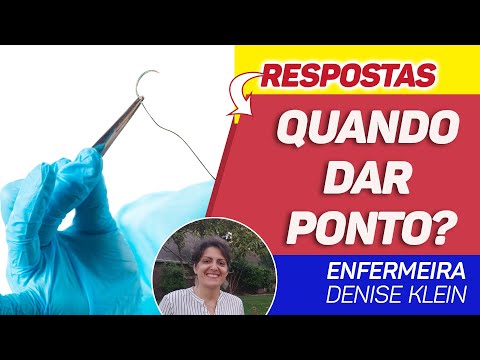 Vídeo: Quando Obter Pontos: Como Saber Se O Seu Corte Precisa Ser Costurado