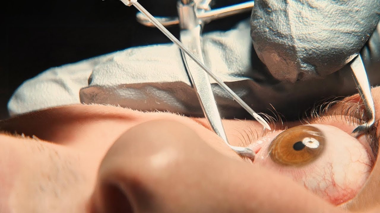 Адамдар көз сұйықтығын алып, оны қартаймау үшін қолданады / кино шолу / қысқа шолу / киномен / нурик